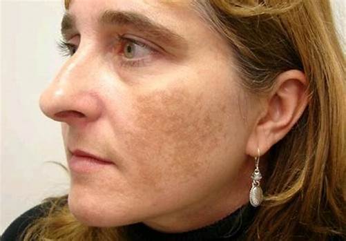 那年脸上的色斑都褪了吗借你古代美人的方法祛今日之斑