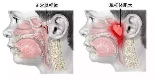 為e