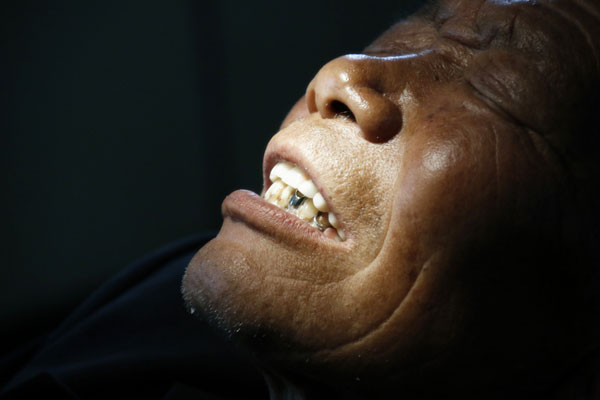 小毛病暗藏健康危机,你中招了吗?