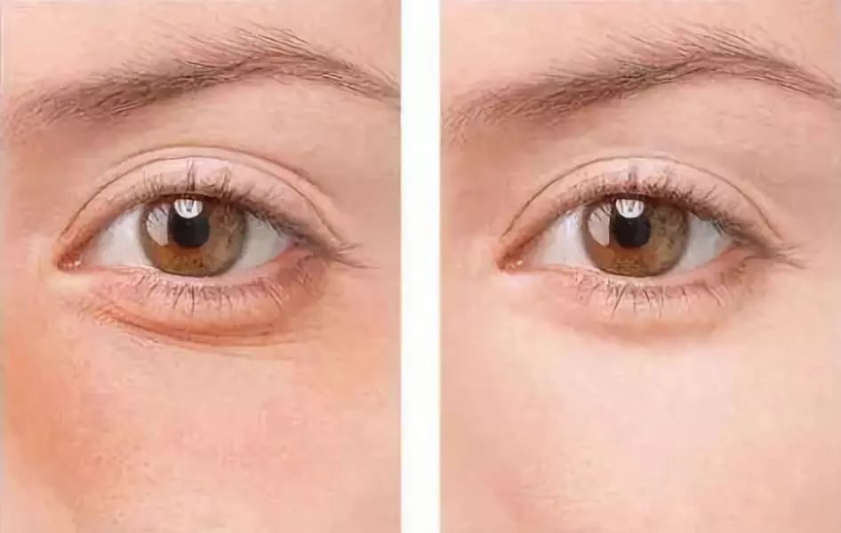 名门泽佳为什么别人皮肤紧致没有细纹年轻10岁秘诀居然是