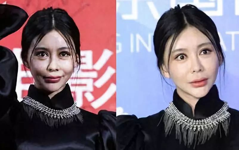 整形脸都不懂整成纯天然的关键是摒弃苦苦挣扎感