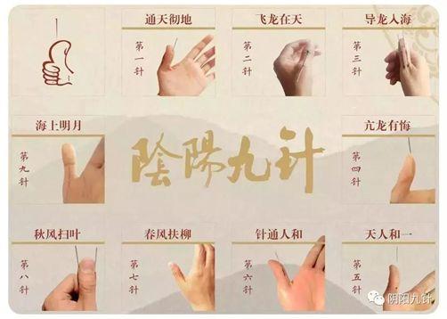 针灸书籍汗牛充栋,《阴阳九针》为什么能够脱颖而出?_凤凰网健康_凤凰网
