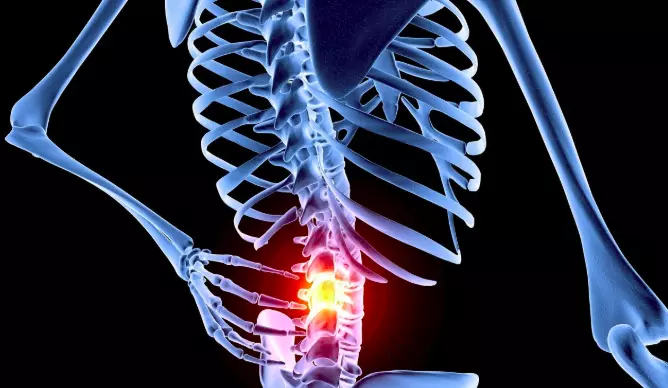 董双海医生提醒:颈背部酸痛不适千万不要拖,当心诱发"神经根型颈椎病"