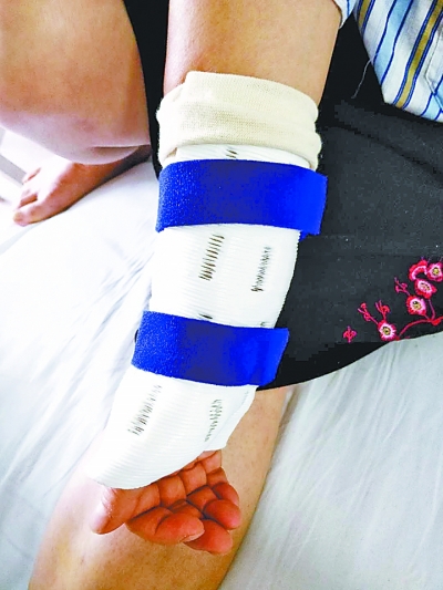 打开凤凰新                      对患者骨折部位进行3d扫描