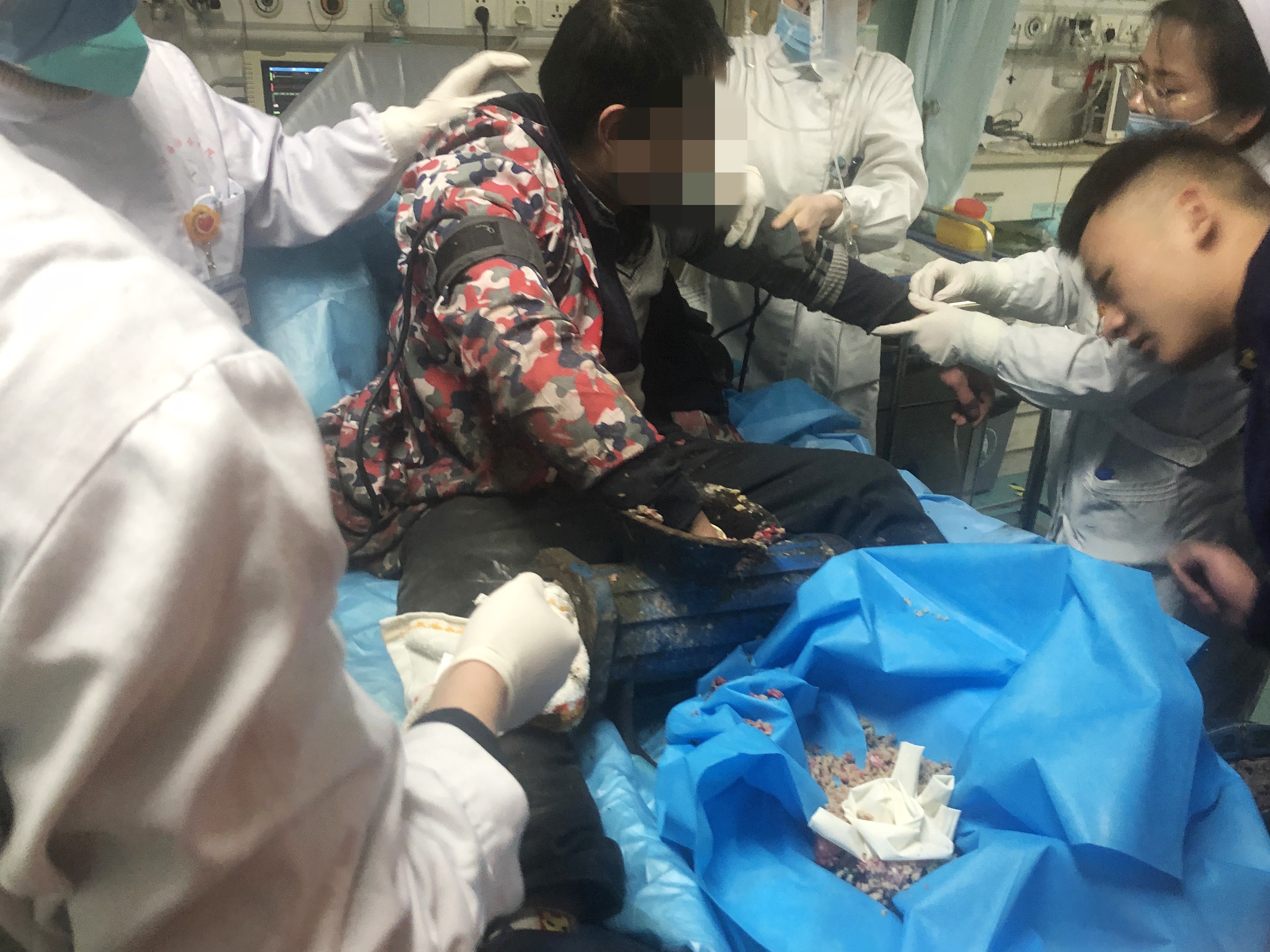 男子手卡进绞肉机五指被绞碎医院消防合力取出