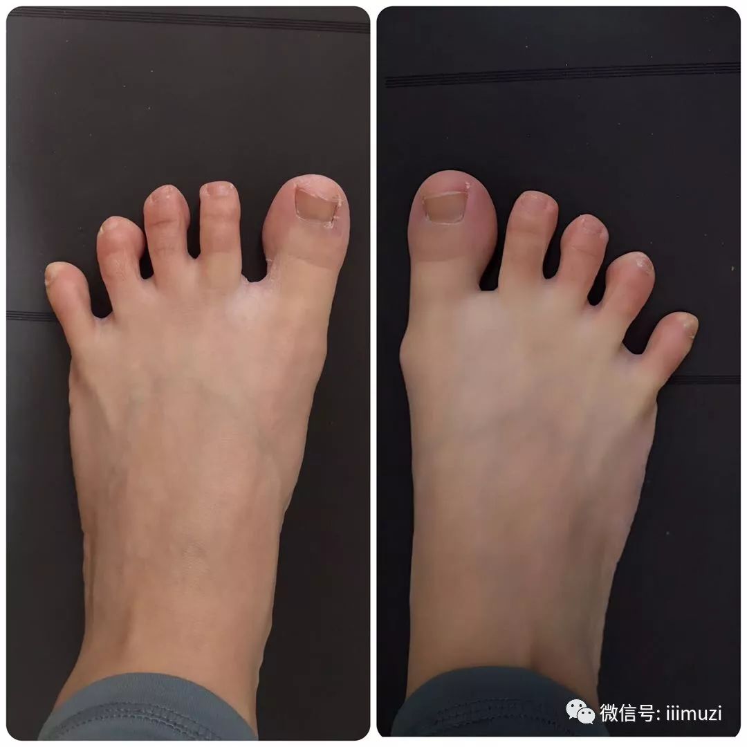 碎碎念脚趾打开边缘伸展