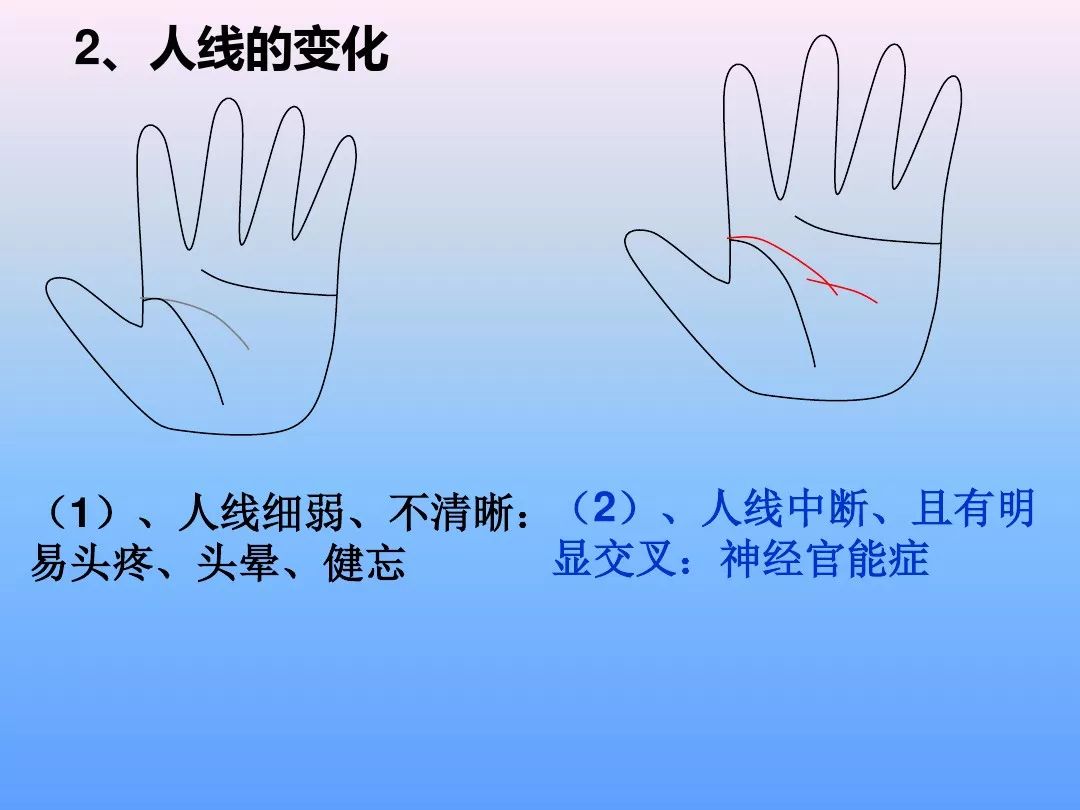 最全手诊（一看就懂）__凤凰网
