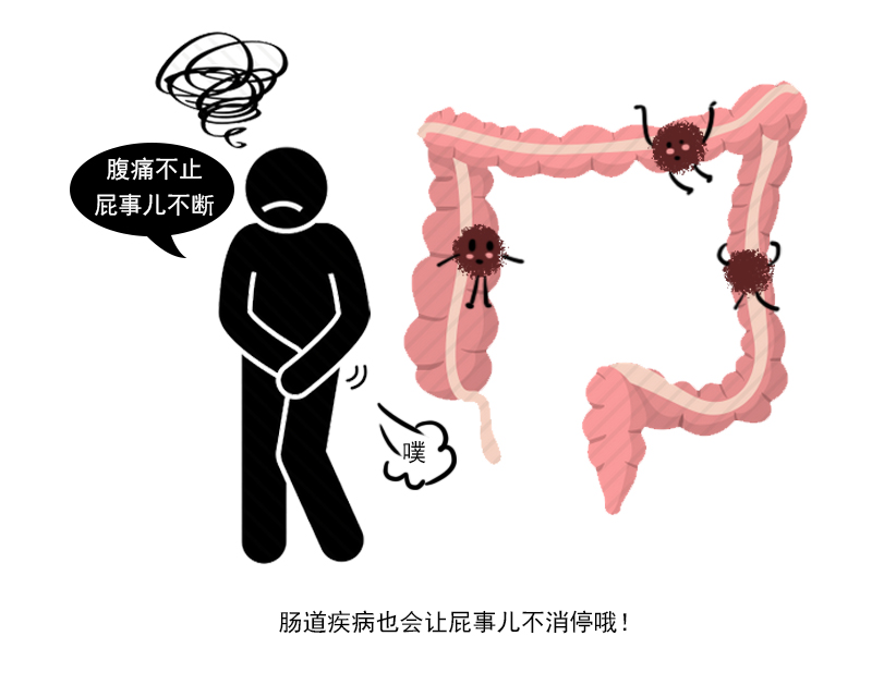 总是放屁,且味道还不好?消化科医生:5种原因你是否曾考虑过__凤凰网