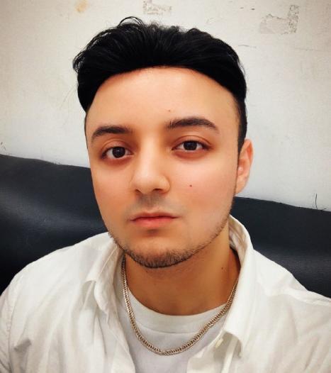 童星阿尔法重回颜值巅峰戴上假发发际线仍然堪忧