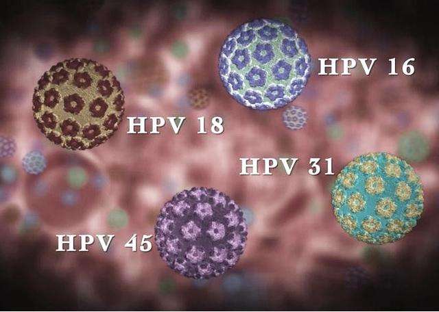 舌頭的小水泡竟是感染hpv?別大意,男女都要小心會要命__鳳凰網