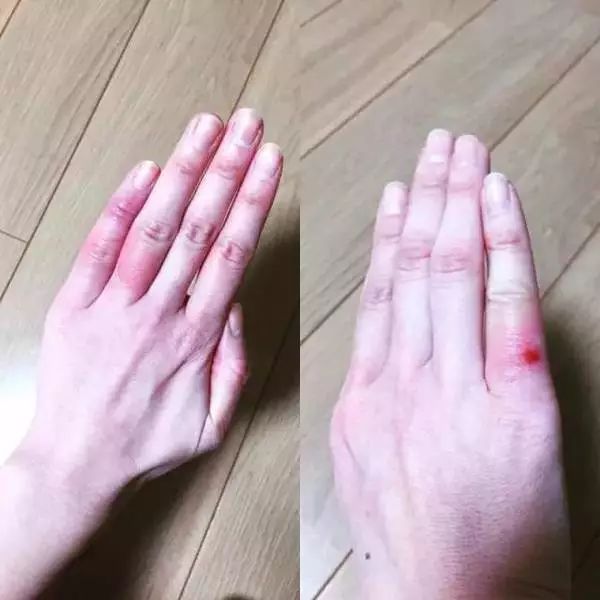 冬天这个流氓,总是冻手冻脚