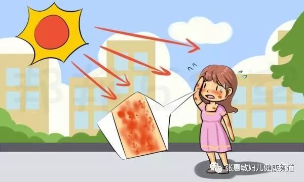 阳光灿烂的日子如何防治日光性皮炎