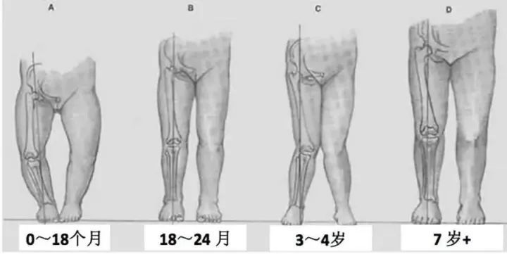 腿夹纸正确使用方法图片