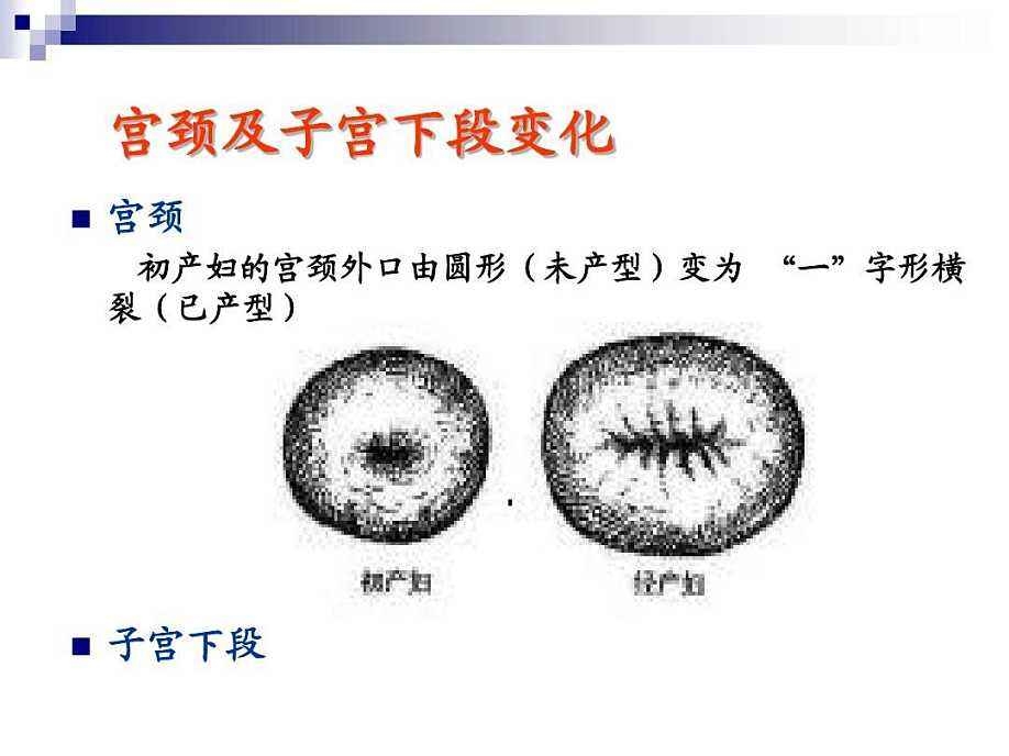 未生育过的女性宫颈口是圆形,生育过或者
