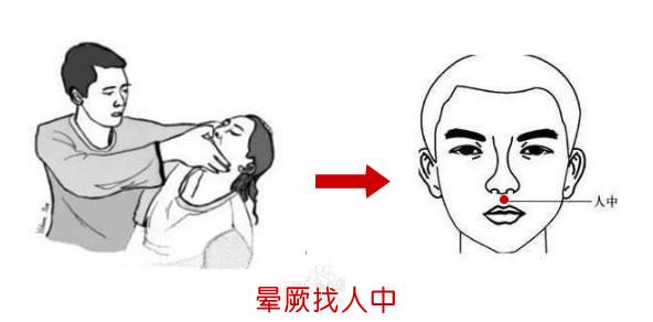 而喻,体质弱或者老年人可能会出现昏迷晕厥症状,此时用指甲掐按人中穴