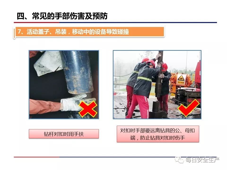 手部受伤事故占所有事故的30%!__凤凰网