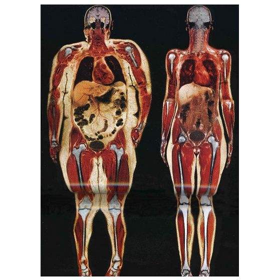 人体脂肪形成过程图解图片