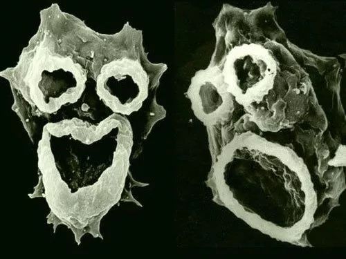 首先是水温,食脑变形虫常见于25度以上的温水环境,在约42度时繁殖能力