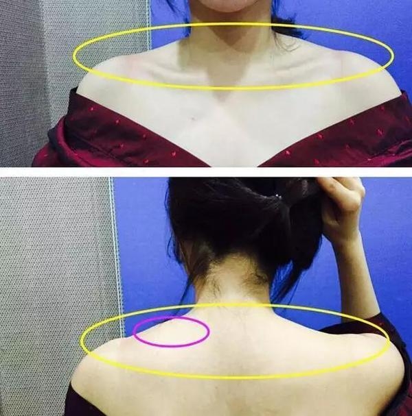 为什么斜方肌肥大看着不好看?    1.看起来虎背熊腰