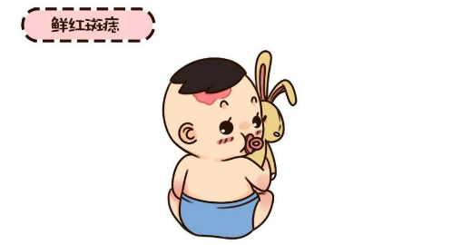 鲜红斑痣早期的症状有哪些