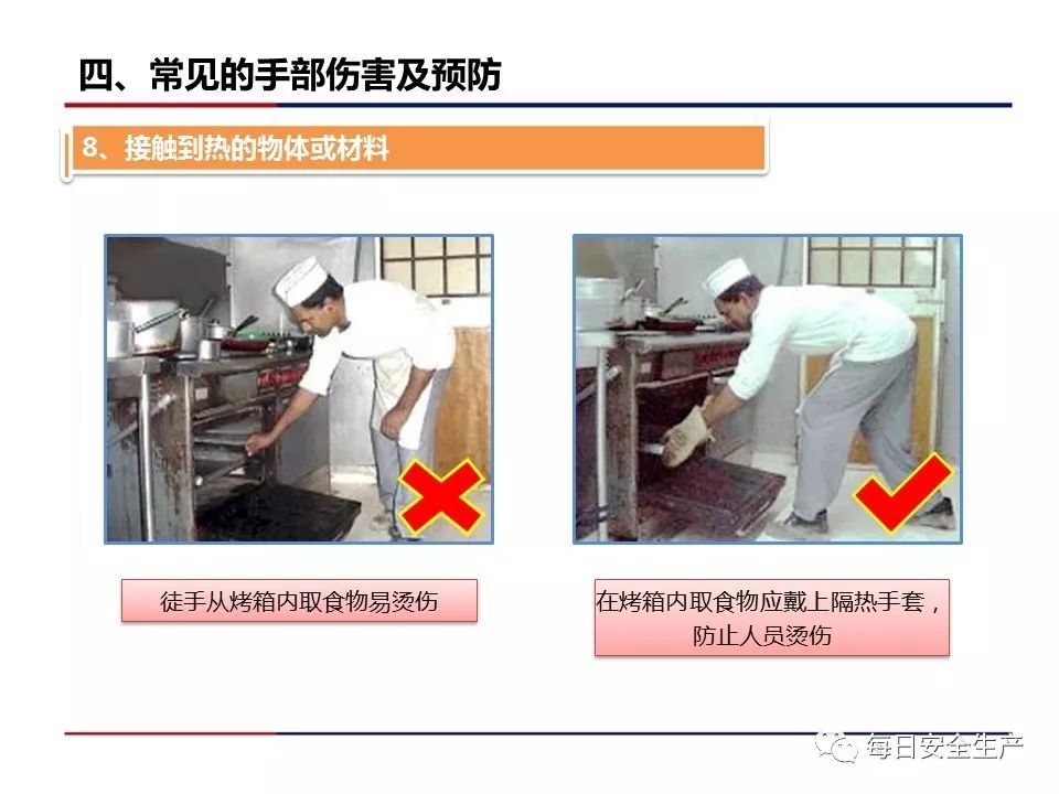 手部受伤事故占所有事故的30%!__凤凰网