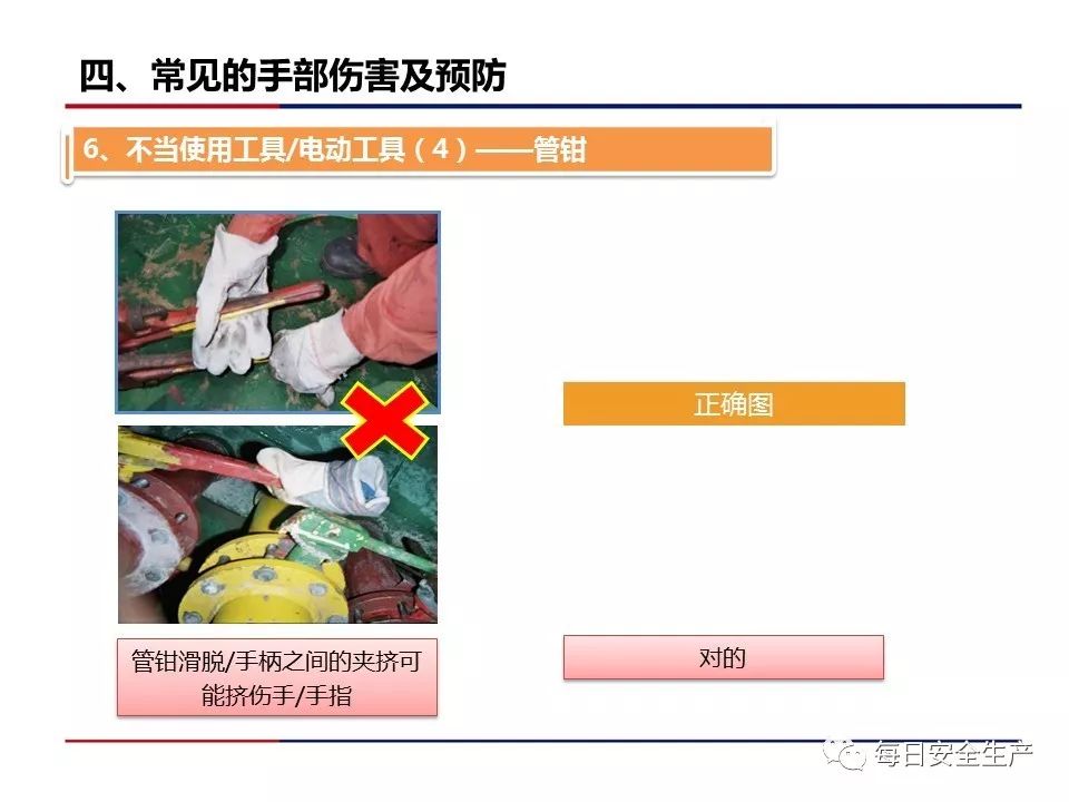 手部受伤事故占所有事故的30%!__凤凰网