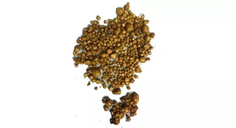 疯狂的石头记|身体里的胆结石是怎么长出来的?__凤凰网