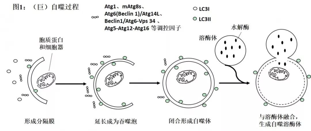 自噬与急性胰腺炎