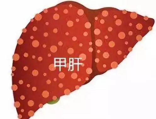 甲肝疫苗美国疾控中心委员会建议更新甲肝疫苗接种建议所有218岁儿童