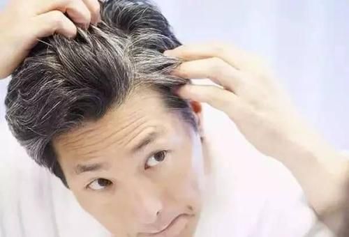 白发越来越多,你一定要有这些坏习惯,赶紧改__凤凰网