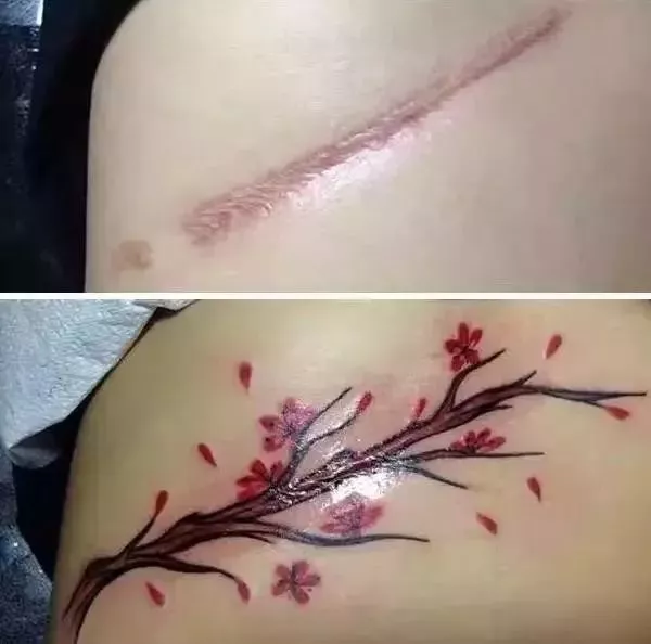 【三思而后行】纹身遮疤,你真的做好准备了?__凤凰网