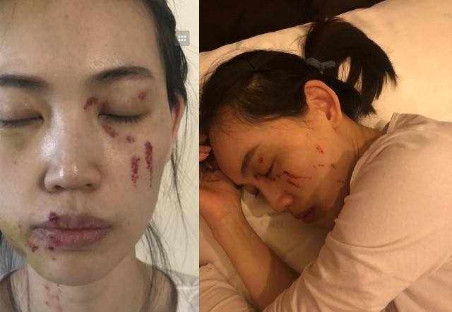 马蓉被打近照曝光,曝出王宝强与现女友孩子三岁多,四年前已出轨__凤凰