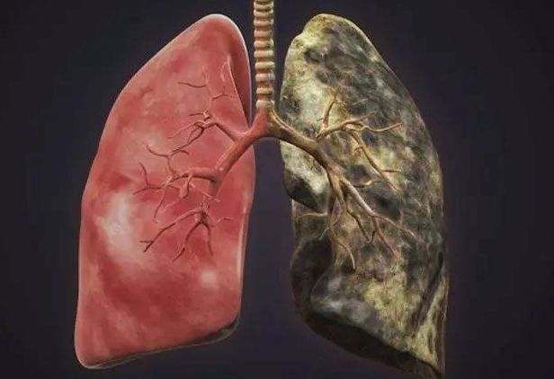 戒烟多久,黑肺才能变白?3物多吃,清肺,排烟毒