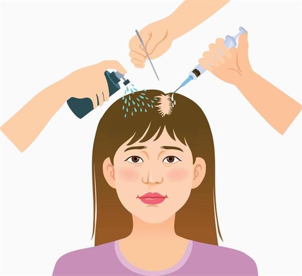 什么是植发手术 毛发移植技术__凤凰网