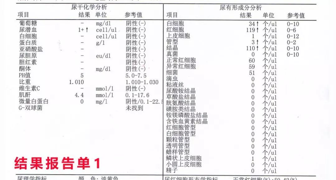 如果尿標本中的粒細胞以淋巴細胞和單核細胞增多為主,則結果會呈現幹