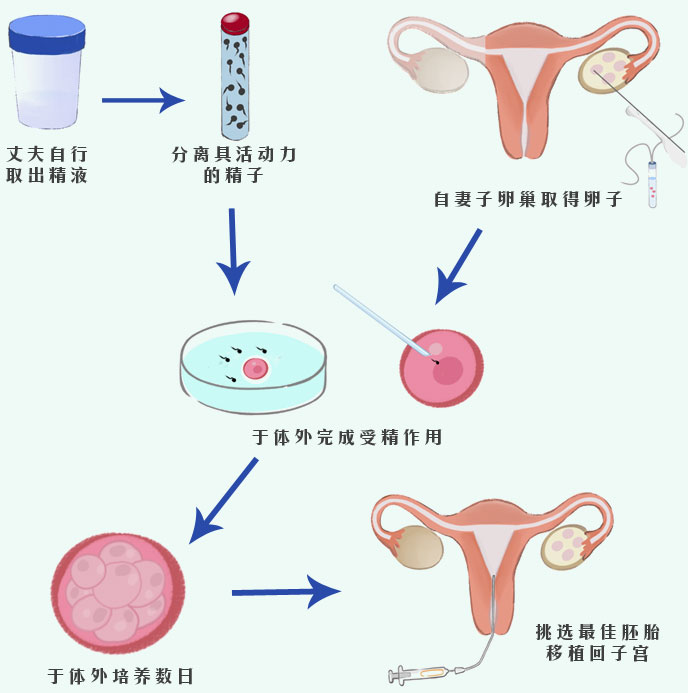 保定试管婴儿流程攻略(保定试管婴儿医院)-第2张图片-鲸幼网