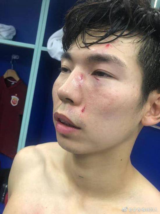 少林功夫好耶?江苏上演踹面门 断腿飞铲,球迷倒戈!