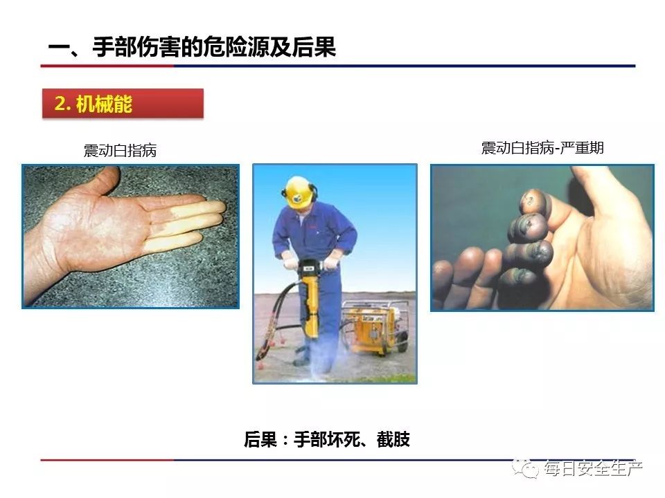 手部受伤事故占所有事故的30%!__凤凰网