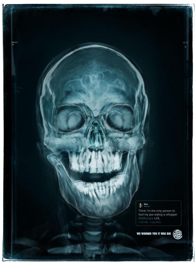 汉堡王推出的新的推广宣传,"我们警告你它很大",x光片展示了一组吃过