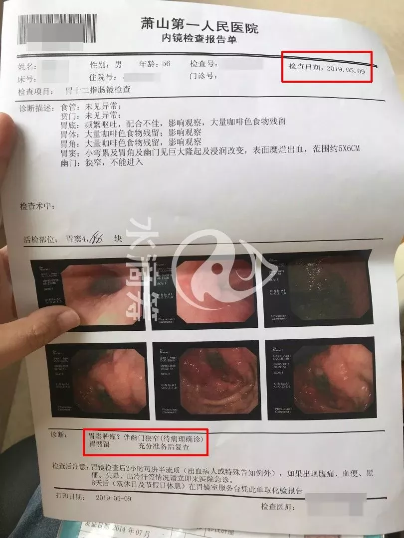 并未确诊胃癌,5月9日的内镜检查报告单上看,不过,从筹款页面晒出的