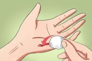 冬季伤口恢复慢会留疤吗,这些护理伤口犯的错看看你有几个?