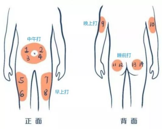 胰岛素打腿的位置图图片