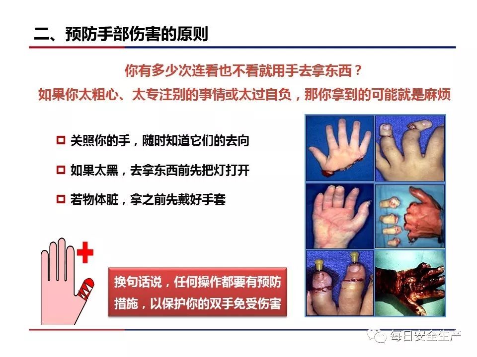 手部受伤事故占所有事故的30%!__凤凰网