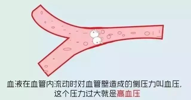 一则生动形象的高血压科普漫画_凤凰网