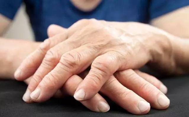 哪些方法可防止晨僵晨僵是类风湿性关节炎患者共有的体征,也是类风湿