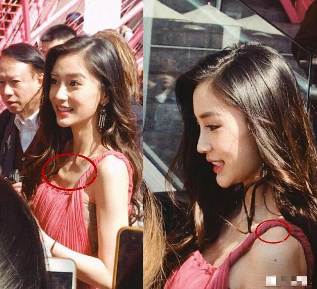 angelababy未修图曝光肋骨突出瘦到吓人撞脸李小璐