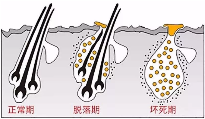 (毛囊克隆還在研究中…)