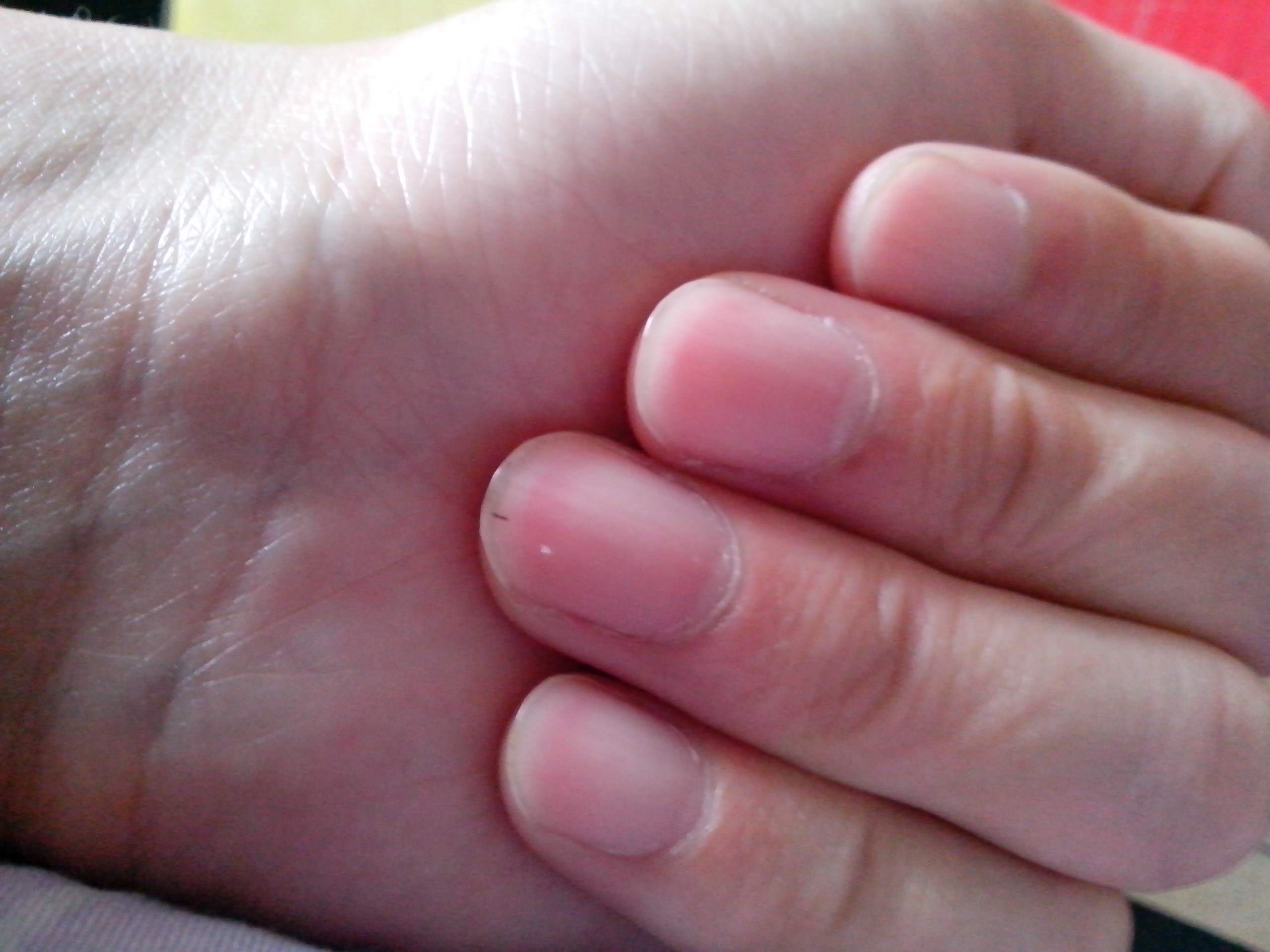 指甲软,易断,如何护理?__凤凰网