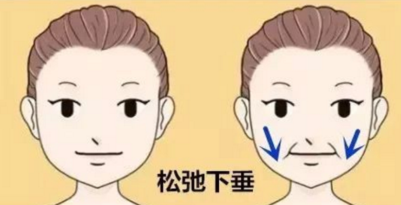 自体脂肪填充可以帮助我们改善的部位有哪些?