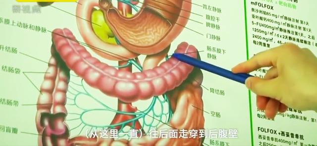 96岁老太年前误吞针竟延期年后就诊家属认为过年住院运气不好